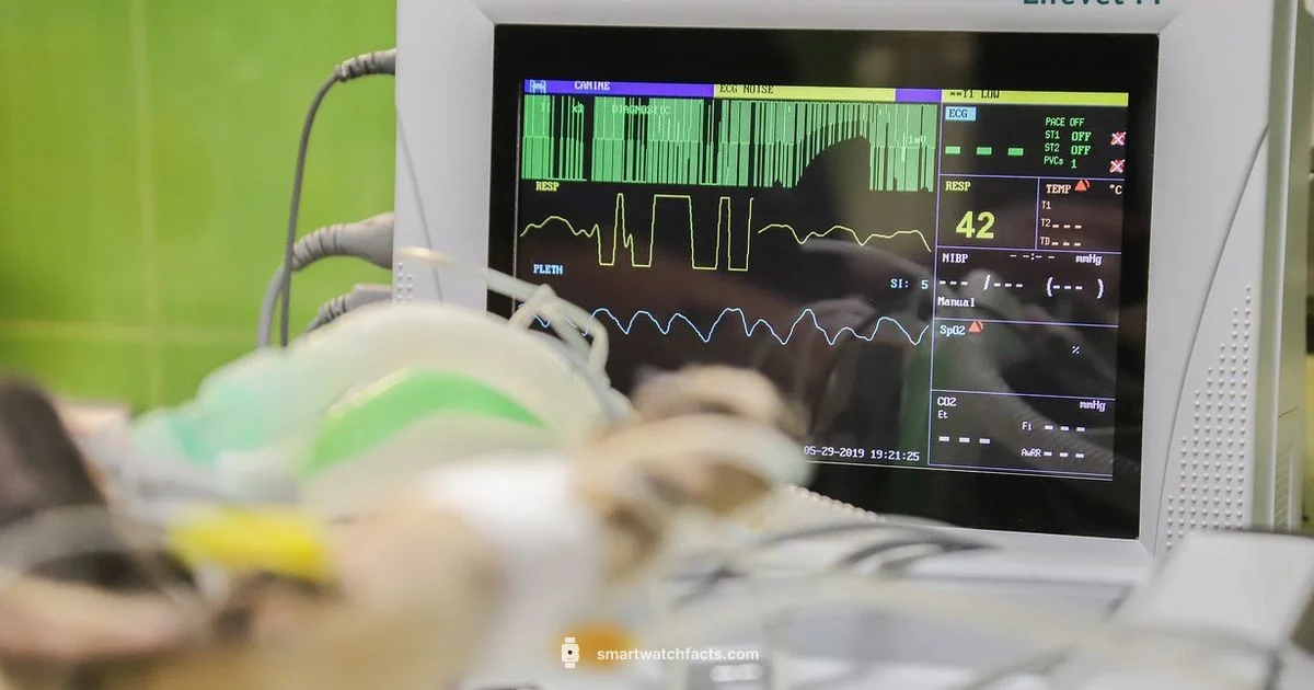 No HR Monitor Watch - Smartwatch Facts