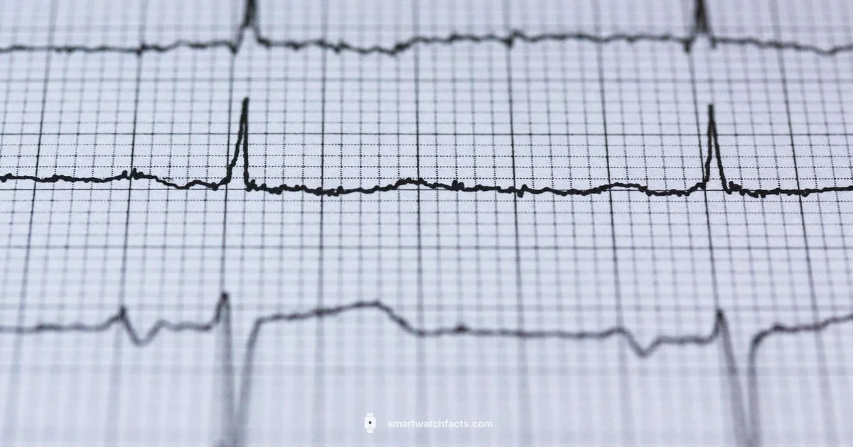 ECG Watches - Smartwatch Facts
